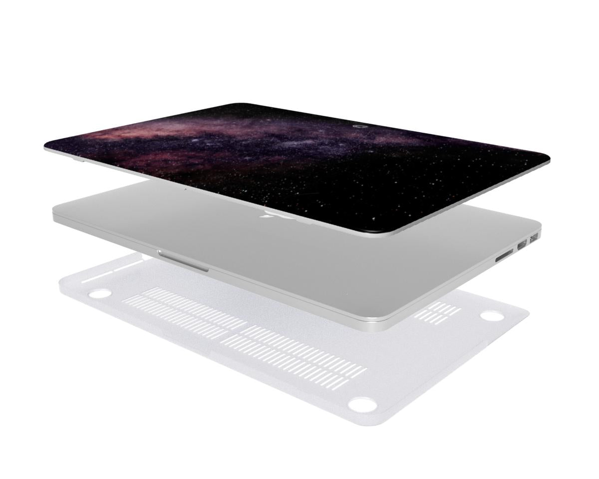 Stellar Burst Macbook Case