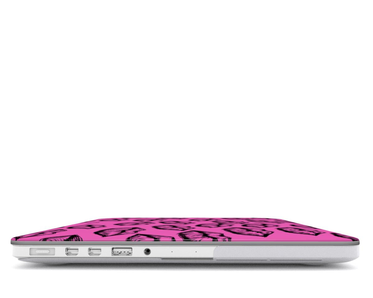 Neon Kisses Macbook Case