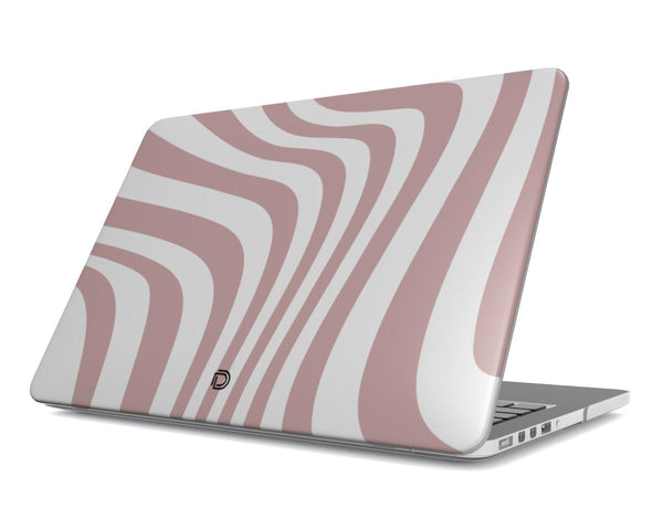 Vibrant Visions Macbook Case