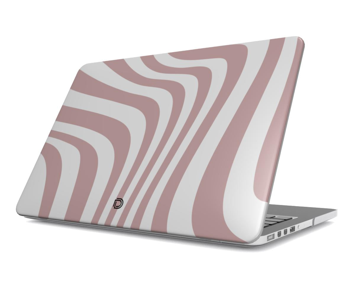 Vibrant Visions Macbook Case