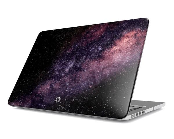 Stellar Burst Macbook Case