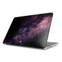 Stellar Burst Macbook Case