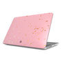 Rose Gold Rush Macbook Case