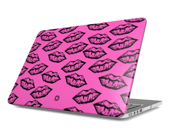 Neon Kisses Macbook Case