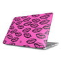 Neon Kisses Macbook Case